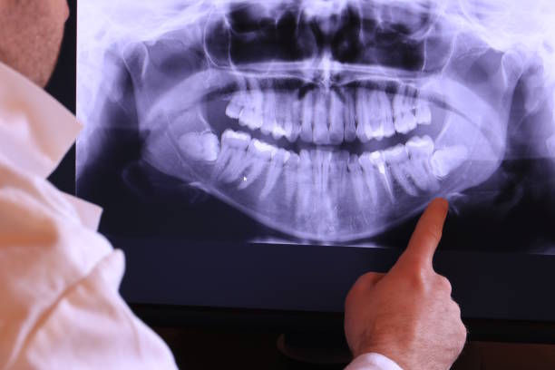 Best Knocked-Out Tooth Emergency  in Fairfax, CA