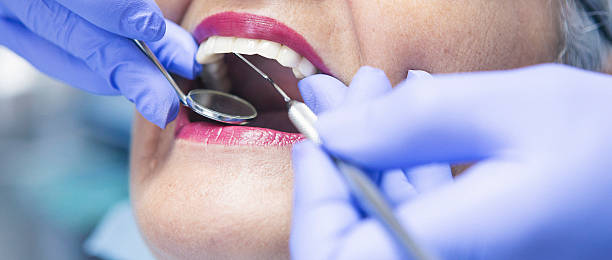 Best Affordable Emergency Dental Care  in Fairfax, CA